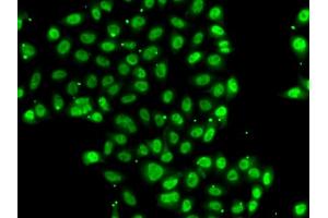 Immunofluorescence analysis of U2OS cells using ZNF148 antibody (ABIN5974210). (ZNF148 anticorps)