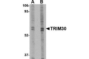 Western Blotting (WB) image for anti-Tripartite Motif Containing 30 (Trim30) (N-Term) antibody (ABIN1031643)
