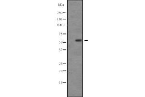Western blot analysis of SGK3 expression in U-87 MG whole cell lysate ,The lane on the left is treated with the antigen-specific peptide. (SGK3 anticorps  (C-Term))