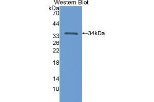 Western blot analysis of the recombinant protein. (NT5C3 anticorps  (AA 1-297))