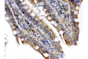 Talin 2 was detected in paraffin-embedded sections of rat intestine tissues using rabbit anti- Talin 2 Antigen Affinity purified polyclonal antibody (Catalog # ) at 1 µg/mL.