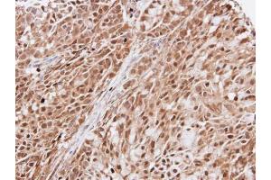 IHC-P Image Immunohistochemical analysis of paraffin-embedded A549 xenograft, using KIAA0494, antibody at 1:100 dilution. (KIAA0494 anticorps  (Center))