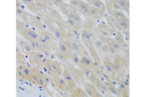 Immunohistochemistry of paraffin-embedded Human liver using PTTG1 Polyclonal Antibody at dilution of 1:100 (40x lens). (PTTG1 anticorps)