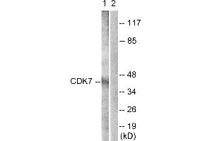 Immunohistochemistry analysis of paraffin-embedded human breast carcinoma tissue using CDK7 (Ab-170) antibody. (CDK7 anticorps  (Thr170))
