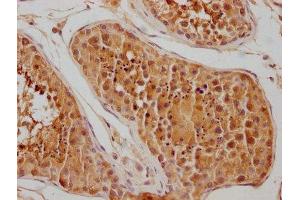 IHC image of ABIN7154847 diluted at 1:100 and staining in paraffin-embedded human testis tissue performed on a Leica BondTM system.