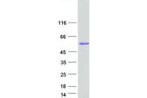 Validation with Western Blot