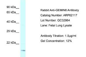 Western Blotting (WB) image for anti-Gem (Nuclear Organelle) Associated Protein 6 (GEMIN6) (Middle Region) antibody (ABIN2789026)