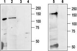 Western blot analysis of Colo205 (lanes 1 and 3), rat liver (lanes 2 and 4) and mouse kidney (lanes 5 and 6) lysates: - 1,2,5. (CASR anticorps  (Extracellular, N-Term))