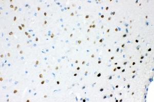 IHC analysis of Ataxin 1 using anti-Ataxin 1 antibody (ABIN3043506). (Ataxin 1 anticorps  (C-Term))
