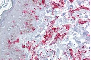 Immunohistochemistry with Skin, dermal fibroblasts tissue at an antibody concentration of 5µg/ml using anti-ZFP36L2 antibody (ARP33383_P050) (ZFP36L2 anticorps  (N-Term))
