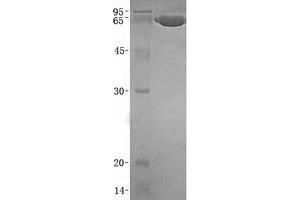 Validation with Western Blot