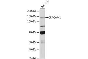 Western blot analysis of extracts of Rat liver, using CE antibody (ABIN7266083) at 1:500 dilution. (CEACAM1 anticorps)