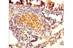 Immunohistochemistry of paraffin-embedded human lung tissue using ABIN7165430 at dilution of 1:100 (FAM161A anticorps  (AA 1-300))