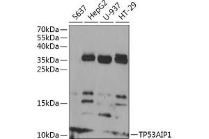 Western blot analysis of extracts of various cell lines, using TP53 antibody (ABIN6130604, ABIN6149410, ABIN6149412 and ABIN6218410) at 1:1000 dilution. (TP53AIP1 anticorps  (AA 1-108))