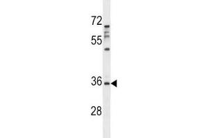 Aurora-C antibody western blot analysis in MDA-MB231 lysate. (Aurora Kinase C anticorps  (AA 3-38))