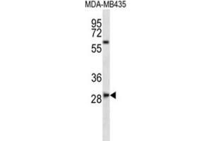Western Blotting (WB) image for anti-SLAM Family Member 8 (SLAMF8) antibody (ABIN2997003)