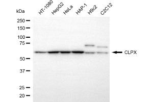Western blotting analysis using CLPX antibody (ABIN7798101). (Recombinant CLPX anticorps)