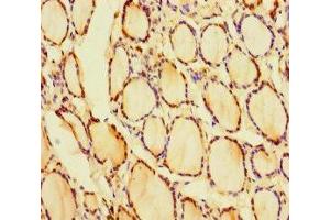 Immunohistochemistry of paraffin-embedded human thyroid tissue using ABIN7153535 at dilution of 1:100 (CRYGN anticorps  (AA 1-182))