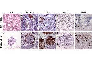 Immunohistochemical staining of tumor biopsy and biopsy spheroid sections. (KRT20 anticorps)