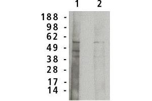 Western blot analysis using acid  sphingomyelinase antibody on normal human brain lysate (7 µg/lane). (SMPD1 anticorps)