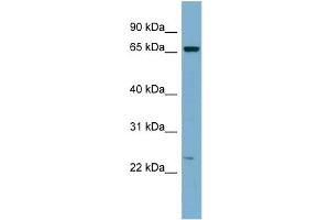 WB Suggested Anti-ZNF572 Antibody Titration:  0. (ZNF572 anticorps  (Middle Region))