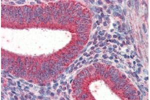 Human Uterus (formalin-fixed, paraffin-embedded) stained with TRIM5 antibody ABIN337284 at 5 ug/ml followed by biotinylated anti-goat IgG secondary antibody ABIN481715, alkaline phosphatase-streptavidin and chromogen. (TRIM5 anticorps  (AA 2-15))