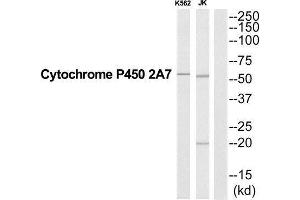 Western Blotting (WB) image for anti-Cytochrome P450, Family 2, Subfamily A, Polypeptide 7 (CYP2A7) (Internal Region) antibody (ABIN1852656) (CYP2A7 anticorps  (Internal Region))