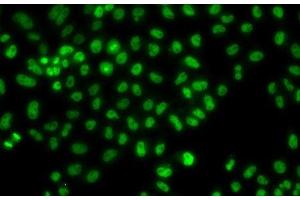 Immunofluorescence analysis of HeLa cells using LHX8 Polyclonal Antibody (LHX8 anticorps)