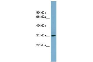 WB Suggested Anti-RNF144B Antibody Titration:  0. (RNF144B anticorps  (Middle Region))