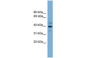 WB Suggested Anti-BNIPL Antibody Titration: 0. (BNIPL anticorps  (Middle Region))