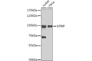 Western blot analysis of extracts of various cell lines, using ATRIP antibody (ABIN1678799, ABIN3019346, ABIN3019347 and ABIN6220835) at 1:1000 dilution. (ATRIP anticorps  (AA 1-260))