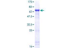 Image no. 1 for Betaine--Homocysteine S-Methyltransferase 2 (BHMT2) (AA 1-363) protein (GST tag) (ABIN1346667)