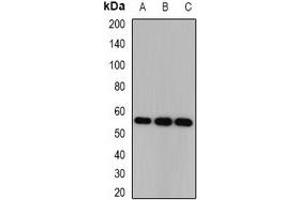 Western blot analysis of CSN1 expression in HEK293T (A), SKOV3 (B), mouse brain (C) whole cell lysates. (GPS1 anticorps)