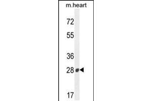 Western blot analysis in mouse heart tissue lysates (35ug/lane). (B3GAT2 anticorps  (AA 123-150))