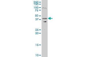 RRAGC polyclonal antibody (A01), Lot # 050801JC01 Western Blot analysis of RRAGC expression in Y-79 .