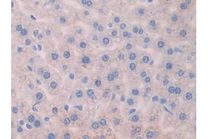 DAB staining on IHC-P; Samples: Mouse Liver Tissue
