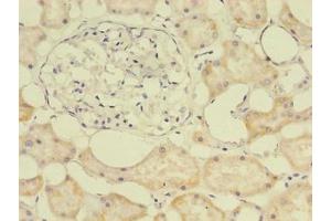 Immunohistochemistry of paraffin-embedded human kidney tissue using ABIN7172517 at dilution of 1:100 (E2F2 anticorps  (AA 1-83))