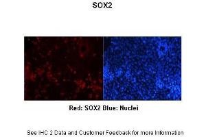 Researcher:Kim Perry, University of Illinois Application:IHC Species+tissue/cell type:Xenopus laevis cornea epithellium Primary antibody dilution:1:300 Secondary antibody:Goat anti-rabbit -rhodamine Secondary antibody dilution:1:300
