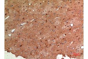 Immunohistochemistry (IHC) analysis of paraffin-embedded Rat Brain, antibody was diluted at 1:100.