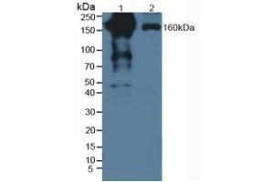 Western blot analysis of (1) Human Serum and (2) Human Lung Tissue. (PZP anticorps  (AA 1212-1391))