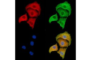 BTF3L3 Antibody staining A549 cells by IF/ICC. (BTF3P13 anticorps)