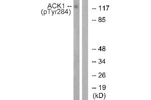 Western blot analysis of extracts from HepG2 cells, treated with EGF (200 ng/mL, 30 mins), using ACK1 (Phospho-Tyr284) antibody.