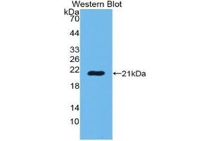 Western blot analysis of the recombinant protein. (POTEG anticorps  (AA 177-330))