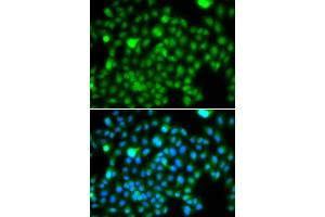 Immunofluorescence analysis of A549 cell using N6AMT1 antibody. (N6AMT1 anticorps)
