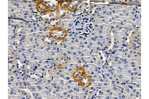 ABIN6262753 and ABIN6279177 at 1/100 staining mouse kidney tissue by IHC-P. (KCNJ8 anticorps)