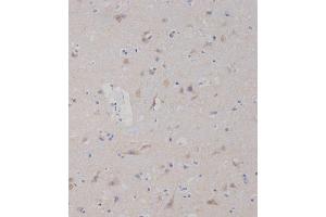 Immunohistochemical analysis of B on paraffin-embedded Human brain tissue was performed on the Leica®BOND RXm.