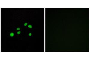 Immunofluorescence (IF) image for anti-Collagen, Type XXIII, alpha 1 (COL23A1) (C-Term) antibody (ABIN1850316)