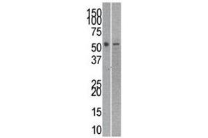 Reptin antibody used in western blot to detect RUVBL2 in mouse kidney (left) and SK-Br-3 (right) lysate (RUVBL2 anticorps  (AA 400-430))