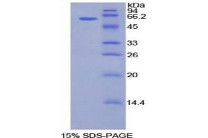 SDS-PAGE analysis of Human CILP Protein. (CILP Protéine)