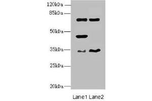 Western blot All lanes: EHF antibody at 4. (EHF anticorps  (AA 1-210))